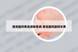 西苑醫(yī)院黃堯洲銀屑病 西苑醫(yī)院副院長黃