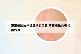 薄芝糖肽治療銀屑病的效果 薄芝糖肽說明書副作用