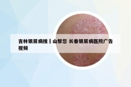吉林銀屑病搜崋山幫您 長春銀屑病醫(yī)院廣告視頻