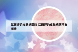 江西好的皮膚病醫(yī)院 江西好的皮膚病醫(yī)院有哪些