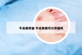 牛皮癬養(yǎng)貓 牛皮膚癬可以養(yǎng)貓嗎