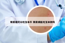 銀屑病可以吃玉米不 銀屑病能吃玉米粥嗎