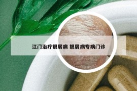 江門(mén)治療銀屑病 銀屑病專病門(mén)診