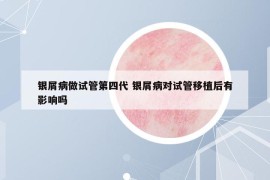 銀屑病做試管第四代 銀屑病對(duì)試管移植后有影響嗎