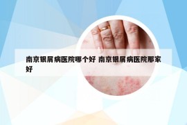南京銀屑病醫(yī)院哪個好 南京銀屑病醫(yī)院那家好