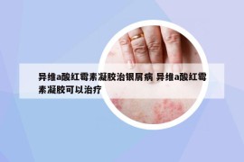 異維a酸紅霉素凝膠治銀屑病 異維a酸紅霉素凝膠可以治療