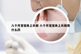 八個(gè)月寶寶身上長癬 八個(gè)月寶寶身上長癬用什么藥