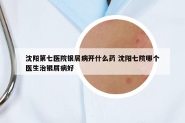 沈陽第七醫(yī)院銀屑病開什么藥 沈陽七院哪個醫(yī)生治銀屑病好