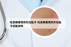 吃百癬夏塔熱片拉肚子 吃百癬夏塔熱片拉肚子還能吃嗎