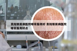 貴陽銀屑病醫(yī)院哪家服務(wù)好 貴陽銀屑病醫(yī)院哪家服務(wù)好點