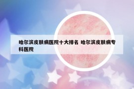 哈爾濱皮膚病醫(yī)院十大排名 哈爾濱皮膚病專科醫(yī)院