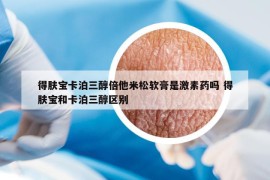 得膚寶卡泊三醇倍他米松軟膏是激素藥嗎 得膚寶和卡泊三醇區(qū)別