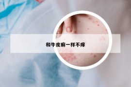 和牛皮癬一樣不癢