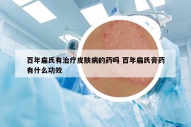 百年扁氏有治療皮膚病的藥嗎 百年扁氏膏藥有什么功效