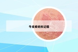 牛皮癬史料記載