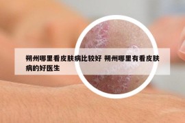 朔州哪里看皮膚病比較好 朔州哪里有看皮膚病的好醫(yī)生