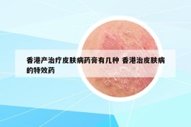 香港產(chǎn)治療皮膚病藥膏有幾種 香港治皮膚病的特效藥