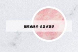 銀屑病換季 銀屑病夏季