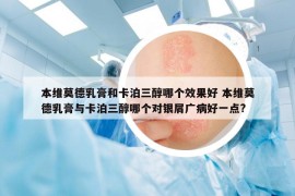 本維莫德乳膏和卡泊三醇哪個(gè)效果好 本維莫德乳膏與卡泊三醇哪個(gè)對銀屑廣病好一點(diǎn)?