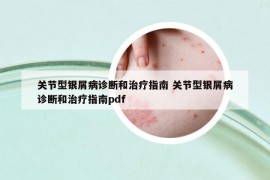 關(guān)節(jié)型銀屑病診斷和治療指南 關(guān)節(jié)型銀屑病診斷和治療指南pdf