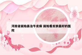 河南省固始縣治牛皮癬 固始看皮膚最好的醫(yī)院