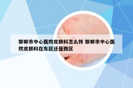 邯鄲市中心醫(yī)院皮膚科怎么樣 邯鄲市中心醫(yī)院皮膚科在東區(qū)還是西區(qū)