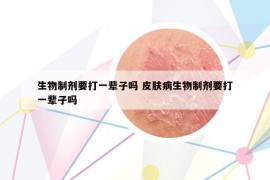 生物制劑要打一輩子嗎 皮膚病生物制劑要打一輩子嗎