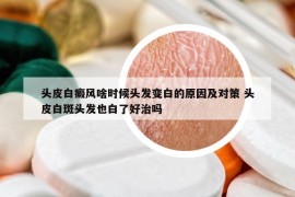 頭皮白癜風(fēng)啥時(shí)候頭發(fā)變白的原因及對(duì)策 頭皮白斑頭發(fā)也白了好治嗎