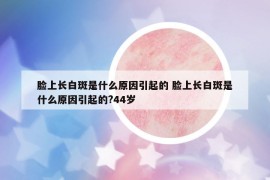 臉上長(zhǎng)白斑是什么原因引起的 臉上長(zhǎng)白斑是什么原因引起的?44歲