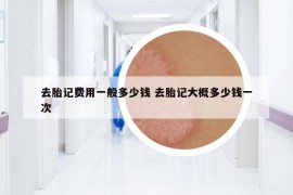 去胎記費(fèi)用一般多少錢 去胎記大概多少錢一次