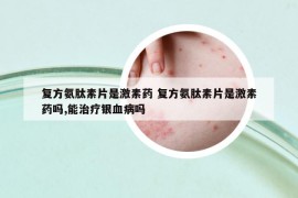 復(fù)方氨肽素片是激素藥 復(fù)方氨肽素片是激素藥嗎,能治療銀血病嗎