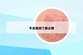 牛皮癬到了靜止期