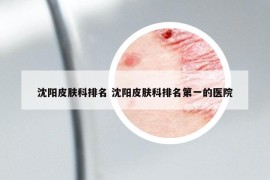 沈陽皮膚科排名 沈陽皮膚科排名第一的醫(yī)院