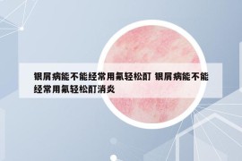 銀屑病能不能經(jīng)常用氟輕松酊 銀屑病能不能經(jīng)常用氟輕松酊消炎