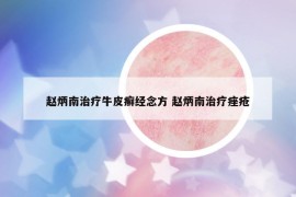 趙炳南治療牛皮癬經(jīng)念方 趙炳南治療痤瘡