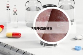 清除牛皮癬城管