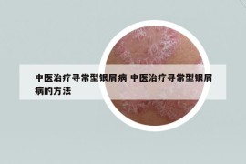 中醫(yī)治療尋常型銀屑病 中醫(yī)治療尋常型銀屑病的方法