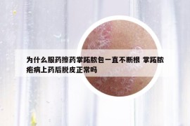 為什么服藥擦藥掌跖膿包一直不斷根 掌跖膿皰病上藥后脫皮正常嗎