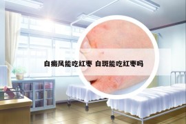 白癜風(fēng)能吃紅棗 白斑能吃紅棗嗎