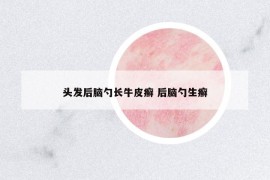 頭發(fā)后腦勺長牛皮癬 后腦勺生癬
