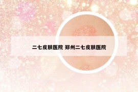 二七皮膚醫(yī)院 鄭州二七皮膚醫(yī)院