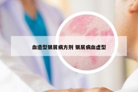 血造型銀屑病方劑 銀屑病血虛型