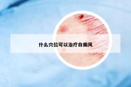 什么穴位可以治療白癜風