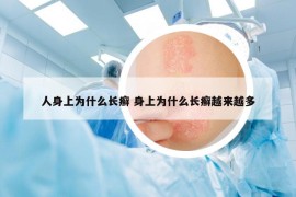 人身上為什么長(zhǎng)癬 身上為什么長(zhǎng)癬越來(lái)越多