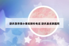 尉氏張市鎮(zhèn)小寨皮膚科電話 尉氏縣皮膚醫(yī)院