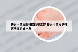 新鄉(xiāng)中醫(yī)皮膚科醫(yī)院哪家好 新鄉(xiāng)中醫(yī)皮膚科醫(yī)院哪家好一點(diǎn)