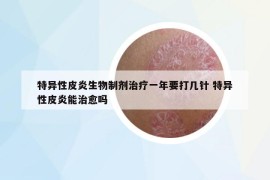 特異性皮炎生物制劑治療一年要打幾針 特異性皮炎能治愈嗎