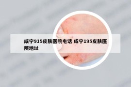 咸寧915皮膚醫(yī)院電話 咸寧195皮膚醫(yī)院地址
