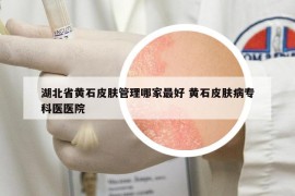 湖北省黃石皮膚管理哪家最好 黃石皮膚病專科醫(yī)醫(yī)院