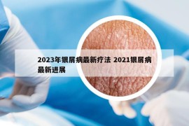 2023年銀屑病最新療法 2021銀屑病最新進展